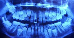 Privacy at the Edge: A Critical Examination of Technology and Personal Data Extraction